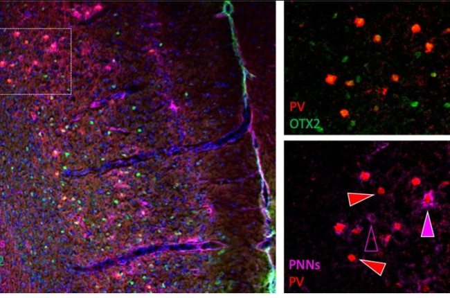 Desentra An El Mecanismo Cerebral Que Regula La Ansiedad