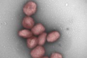 El virus de la verola del mico també podria transmetre's per via aèria