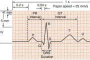 electrocardiograma: 