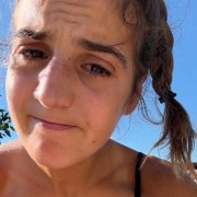 Sara Alonso, con morados en la cara después del incidente.