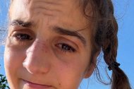 Sara Alonso, con morados en la cara después del incidente.