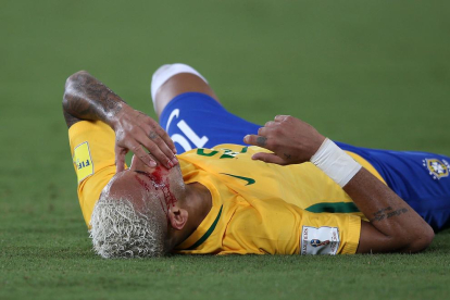 Neymar, ajagut a la gespa amb la cara ensagnada després del cop de colze que li va clavar un rival.