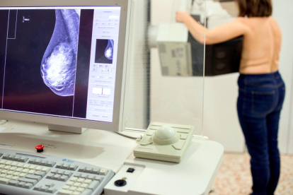 Una dona sotmetent-se a una mamografia.