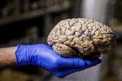 Imatge d'arxiu del cervell humà