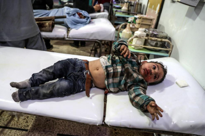Un nen rep tractament mèdic en un hospital després de resultar ferit en un bombardeig a Douma.