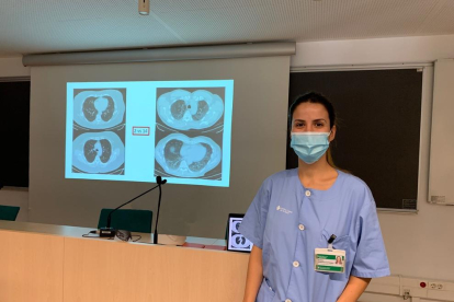 La doctora Jessica González Gutiérrez, facultativa especialista del servicio de Pneumologia del Hospital Universitario Arnau de Vilanova de Lleida.