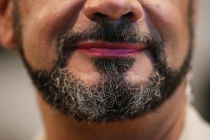 No només es trasplanta pèl per evitar la calvície, també per lluir barba