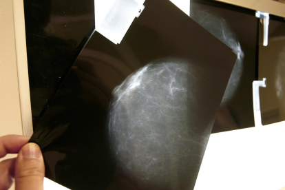 Una prueba radiológica de mama.