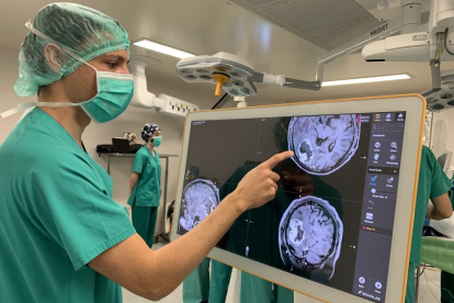 Imatge d'una intervenció quirúrgica d'extirpació de tumor cerebral a quiròfan amb l'ús del nou micro.