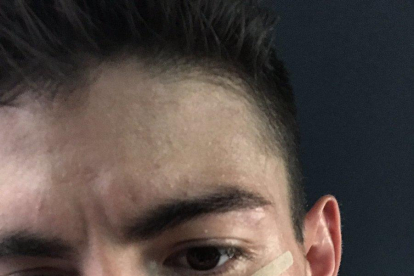 Bernat Font va publicar aquesta foto del seu rostre ferit.