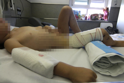 Imatges de la nena preses ahir a l'hospital, sis dies després de ser brutalment atacada per un gos en un carrer d'Alcarràs.