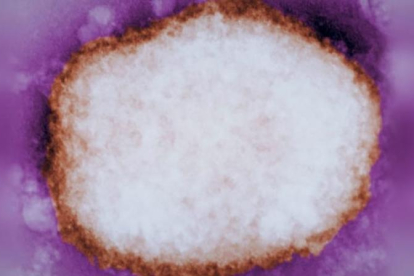 Partícula amplificada del virus de la verola del mico.