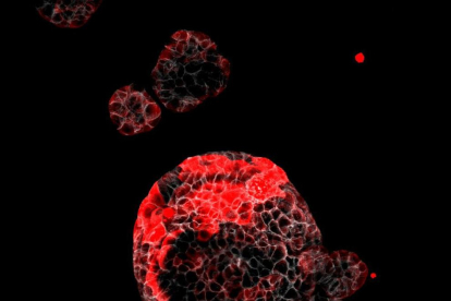 Organoide de càncer colorectal amb cèl·lules residuals responsables de la recaiguda marcades en roig.