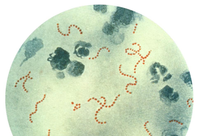 Bacteria 'streptococcus pyogenes'.