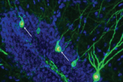 El nuevo estudio muestra que impulsar la neurogénesis aumenta la cantidad de neuronas recién formadas involucradas en el almacenamiento y la recuperación de recuerdos (flechas) en el hipocampo de ratones con alzhéimer.