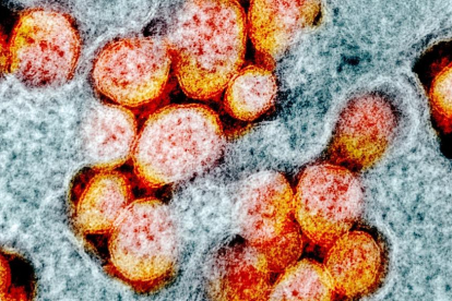 Micrografia electrònica de transmissió de partícules del coronavirus SARS-CoV-2, aïllades d'un pacient en els primers mesos de la pandèmia.