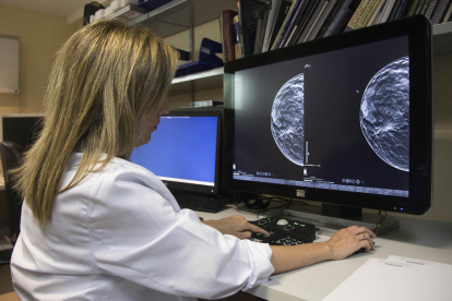 El càncer de mama metastàsic es propaga més ràpidament a la nit, segons un nou estudi
