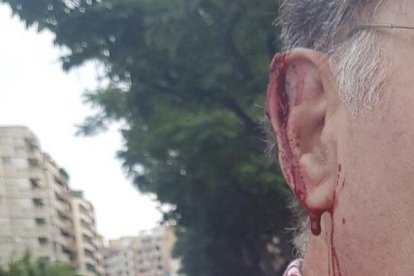 Un hombre denuncia que ha sido agredido en Lleida por un grupo que arrancaba carteles y lazos amarillos