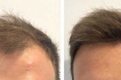 El resultat d'una intervenció.