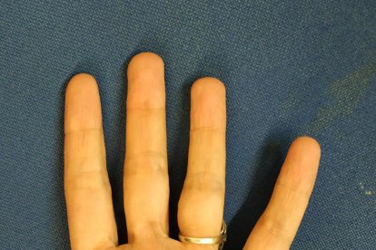 Imatges del senyal de socors internacional que serveix per denunciar una situació de violència masclista.