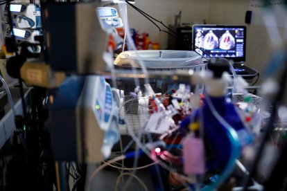 Investigadores catalanes consiguen que un feto sobreviva 12 días en una placenta artificial