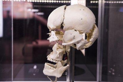nervis i artèries. En groc, els nervis cranials, i en vermell i blau, l’artèria caròtida externa i les seves rames.