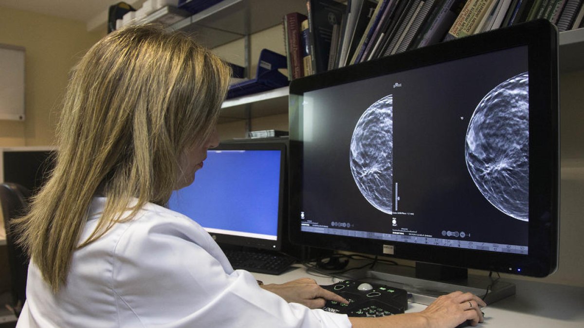 Demanen incloure el càncer de mama en la llista europea de malalties professionals