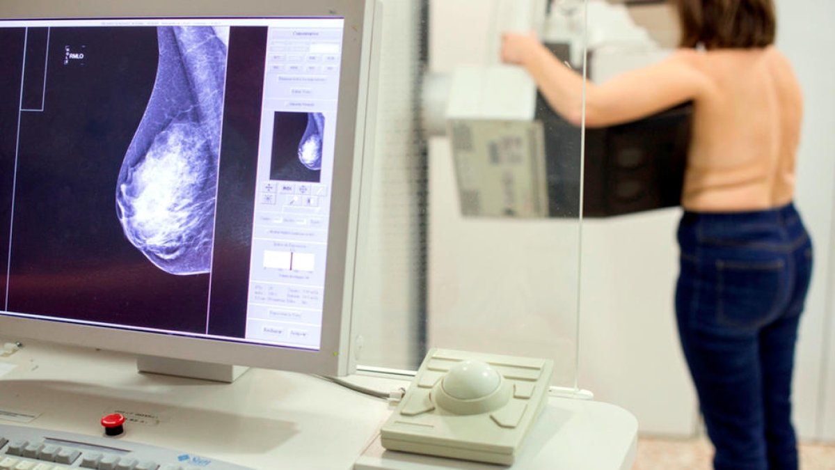 Una mujer sometiéndose a una mamografía.