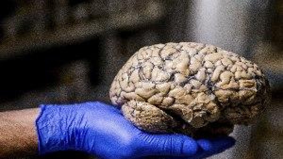 Imatge d'arxiu del cervell humà