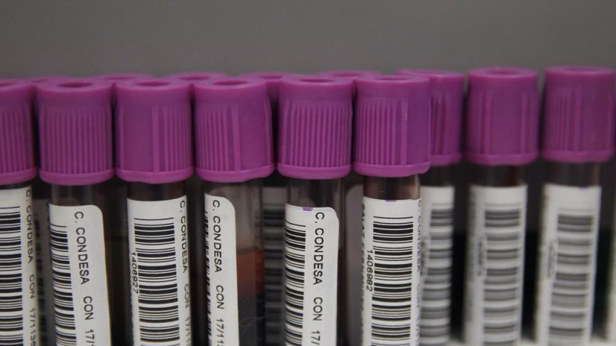 Proves de laboratori per realitzar el test del VIH.