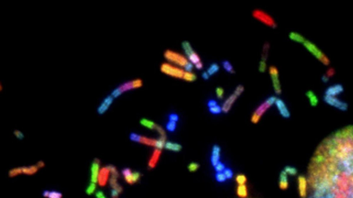 La mutació d'un sol gen desencadena el desenvolupament d'un tipus de càncer d'ovari, segons un estudi espanyol