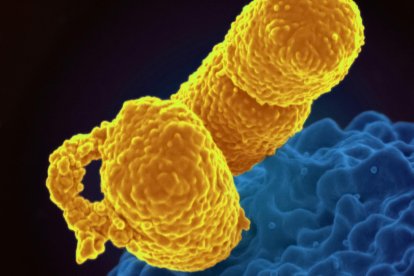 National Institute of Allergy and Infectious Diseases / Unsplash