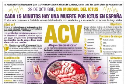 Infografía de EFE sobre el Día del Ictus