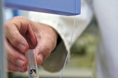 La supervivència en pacients amb càncer renal metastàtic augmenta del 5 al 30%