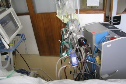 ECMO