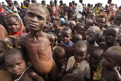 Niños de la etnia Turkana con graves problemas de malnutrición.