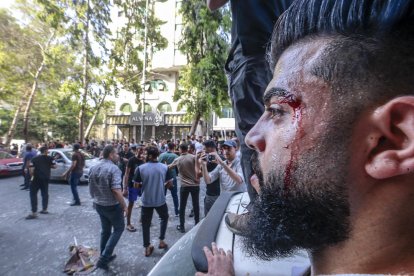 Un palestino herido en la zona de los ataques israelíes en Gaza.