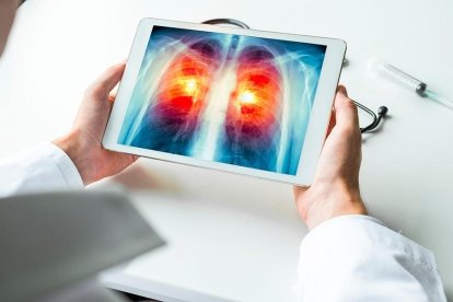 Señales inusuales en las manos podrían alertar sobre el cáncer más letal