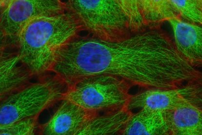 Un estudio muestra cómo algunos cánceres pueden desactivar el sistema inmune y crecer sin control