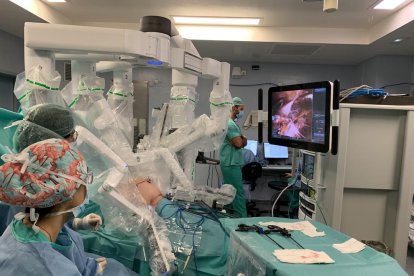 Professionals de la Unitat de Cirurgia de la Paret Abdominal de l'Hospital Arnau de Vilanova de Lleida realitzen una cirurgia fent servir el robot Da Vinci.

Data de publicació: dilluns 17 d'octubre del 2022, 13:03

Localització: Lleida

Autor: