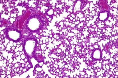 Pulmones de ratón con píldora viva activa combatiendo Pseudomonas aeruginosa