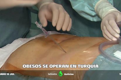 Muchos españoles van a Turquía para retoques y cirugía estética.