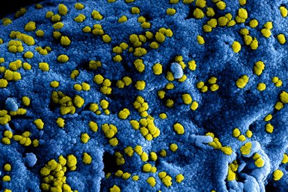 El norovirus afecta al estómago.