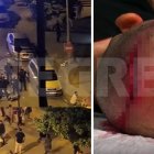Així va quedar el cap d'un dels mossos agredits en la turba de la Mariola
