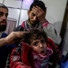 Un nen ferit per un bombardeig a l’est de Ghouta és atès en un hospital de Duma a Síria.