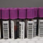 Proves de laboratori per realitzar el test del VIH.