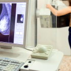 Una dona es fa una mamografia.