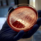 Vista d'un cultiu de listeriosi en una placa de Petri