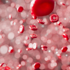 Un estudi revela la importància del grup sanguini en els ictus prematurs.