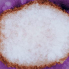 Partícula amplificada del virus de la viruela del mono.